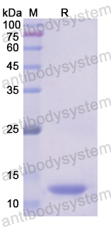 Recombinant Human ALDH2 Protein, N-His