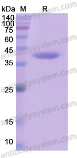 Recombinant Human CYP17A1 Protein, N-His