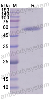 Recombinant Human CD18/ITGB2 Protein, N-GST