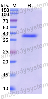 Recombinant Human CYP11A1 Protein, N-His