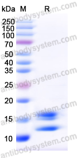 Recombinant Human Calprotectin (S100A8/S100A9) Protein, N-His-Strep