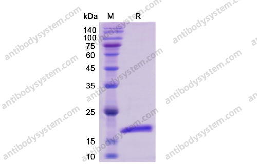 Recombinant Human IL4 Protein, C-His