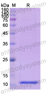 Recombinant Human HMGN1 Protein, N-His