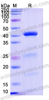 Recombinant Human SERPINE1/PAI-1 Protein, N-His