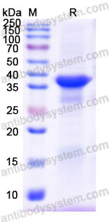 Recombinant Human SERPINA5 Protein, N-His