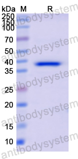 Recombinant Human CFI Protein, N-His