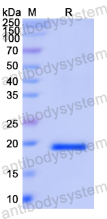 Recombinant Human ISG15 Protein, N-His