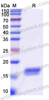 Recombinant Human PCCA Protein, N-His