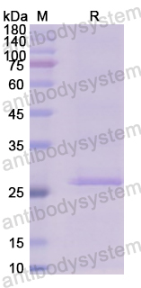 Recombinant Human PCCB Protein, N-His