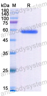 Recombinant Human ALPL Protein, N-His