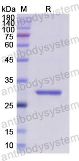 Recombinant Human EIF2S1 Protein, N-His