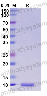 Recombinant Human HMGN2 Protein, N-His