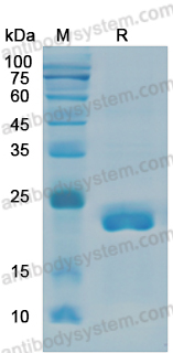 Recombinant Human IL6 Protein, N-His