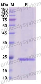 Recombinant Human EDN1/Endothelin-1 Protein, N-His