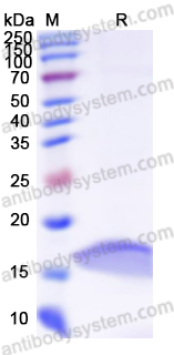 Recombinant Human FABP3 Protein, N-His