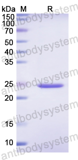 Recombinant Human SSB Protein, N-His