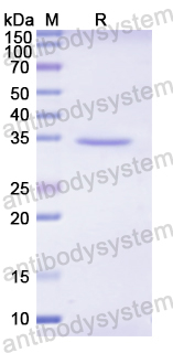 Recombinant Human SERPINA7 Protein, N-His