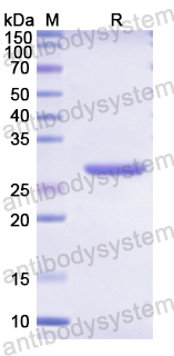 Recombinant Human SERPIND1 Protein, N-His