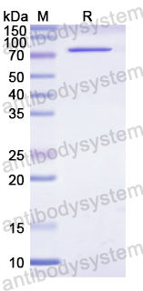 Recombinant Human CD29/ITGB1 Protein, N-His