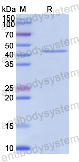 Recombinant Human CD29/ITGB1 Protein, N-His