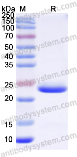 Recombinant Human KRT18 Protein, N-His