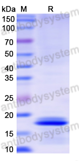 Recombinant Human KRT8/CK-8 Protein, N-His