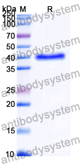 Recombinant Human KRT8/CK-8 Protein, N-His