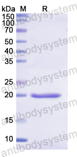 Recombinant Human CSN2 Protein, N-His