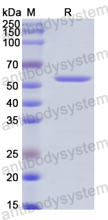 Recombinant Human CALB1 Protein, N-GST