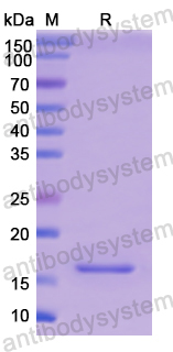 Recombinant Human MYL1 Protein, N-His