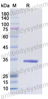 Recombinant Human CD1A Protein, N-His