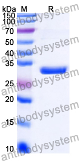 Recombinant Human LCK Protein, N-His