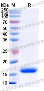 Recombinant Human BCHE Protein, N-His