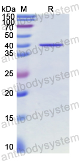 Recombinant Human GLA Protein, N-His