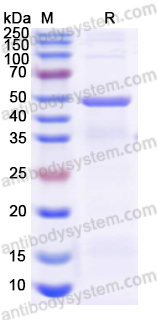 Recombinant Human GSN Protein, N-His