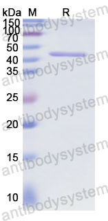 Recombinant Human RB1 Protein, N-GST