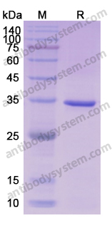 Recombinant Human CDK1 Protein, N-His