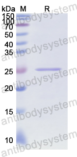 Recombinant Human C2 Protein, N-His