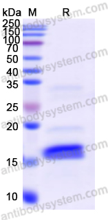 Recombinant Human S100A9 Protein, N-His