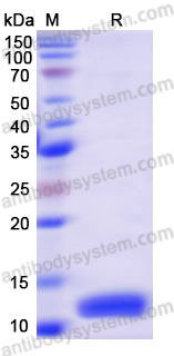 Recombinant Human S100A6 Protein, N-His