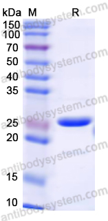 Recombinant Human CD66e/CEA/CEACAM5 Protein, N-His