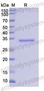 Recombinant Human CD23/FCER2 Protein, N-His