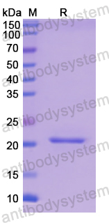 Recombinant Human PYGL Protein, N-His