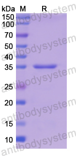 Recombinant Human TPM3 Protein, N-His