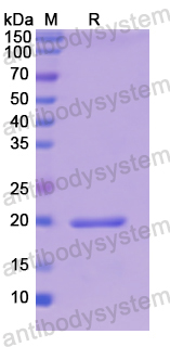 Recombinant Human CRH Protein, N-His