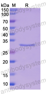 Recombinant Human LPL Protein, N-His