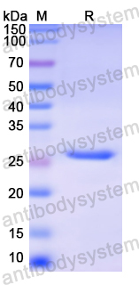 Recombinant Human HEXA Protein, N-His