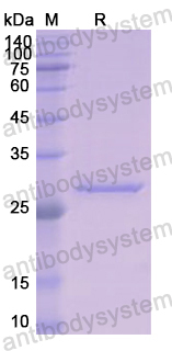 Recombinant Human KLK1 Protein, N-His