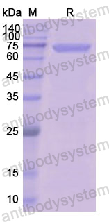 Recombinant Human LIPF Protein, N-GST