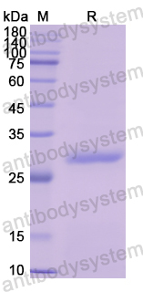 Recombinant Human TH Protein, N-His